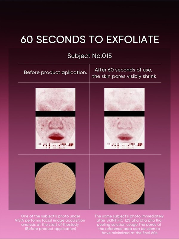 12% AHA BHA PHA LHA Peeling Solution 3