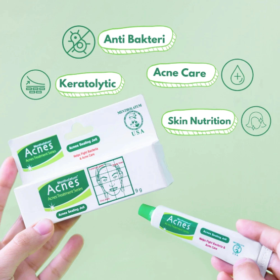 Acnes Acnes Sealing Jell 