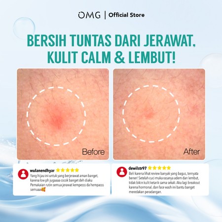 Paragon Technology and Innovation OMG Salicylic Acid Cica Low pH Gel Cleanser