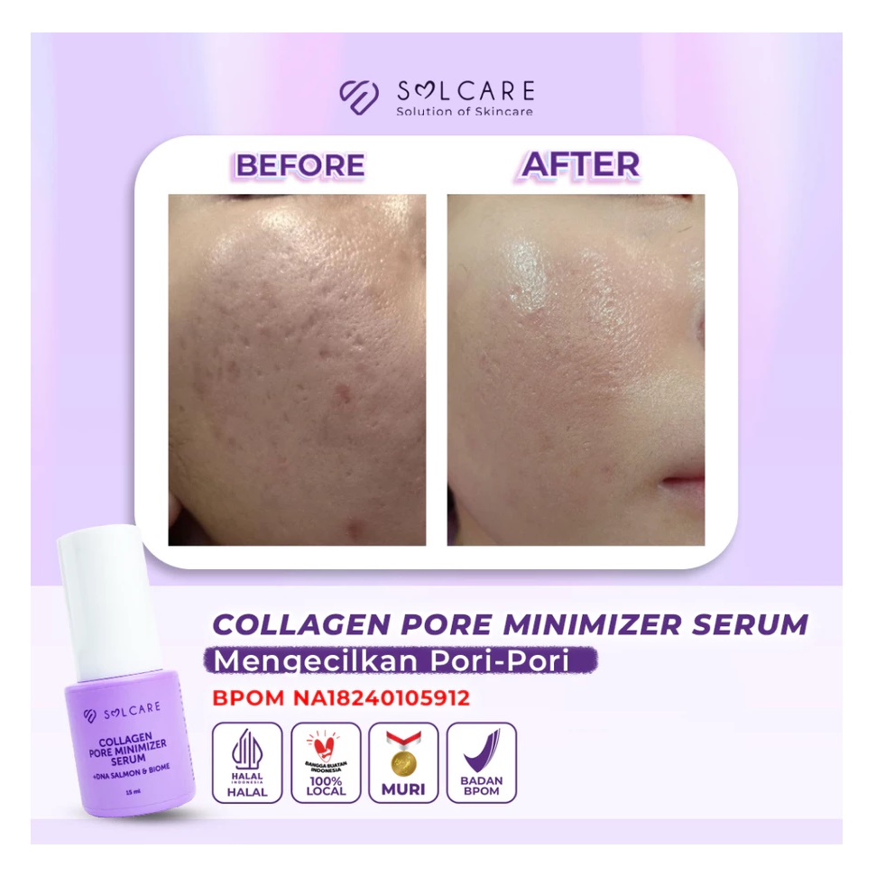 STC Sarana Estetika Solcare Collagen Pore Minimizer Serum