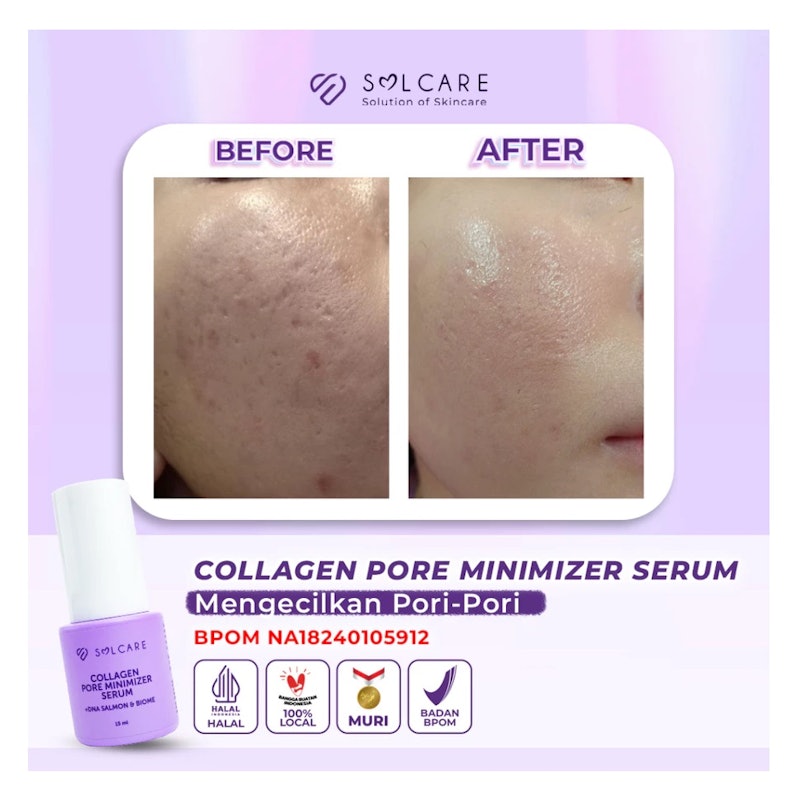 Solcare Collagen Pore Minimizer Serum 3