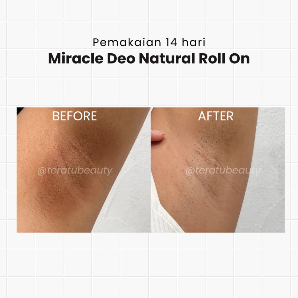 Fandi Universal Kosmekreasi Tératu Beauty Miracle Deo Natural Roll On