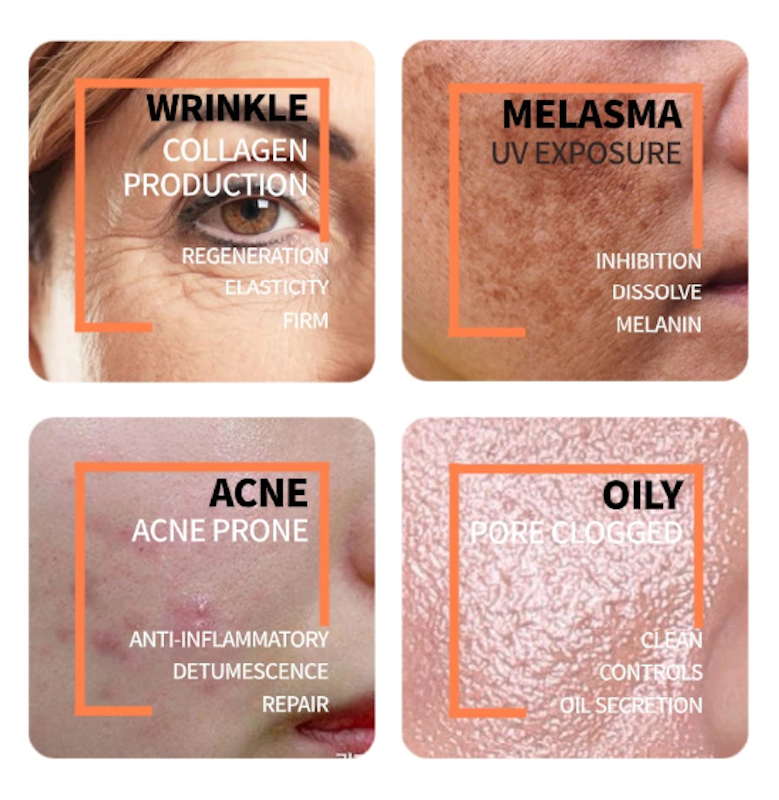 Granactive Retinoid 2% Emulsion 4