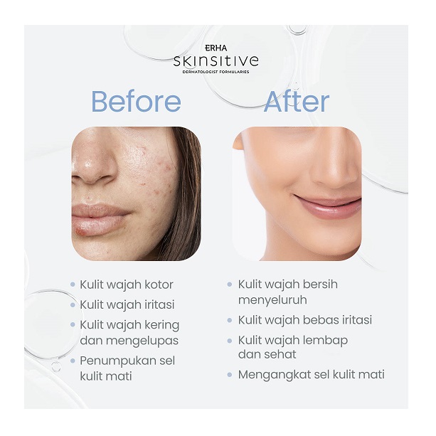 ERHA Clinic Indonesia ERHA Skinsitive Ultracalm Face Wash