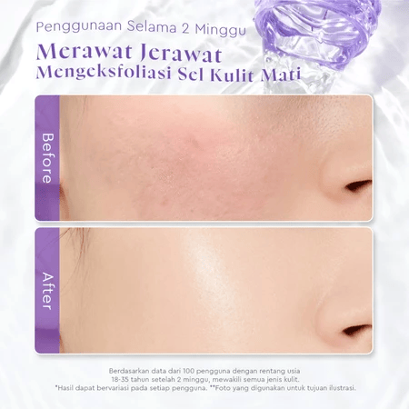 Suntone Wisdom Indonesia  Glad2Glow Blackberry AHA BHA PHA Daily Exfoliating Toner