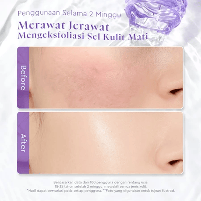 Glad2Glow Blackberry AHA BHA PHA Daily Exfoliating Toner 3