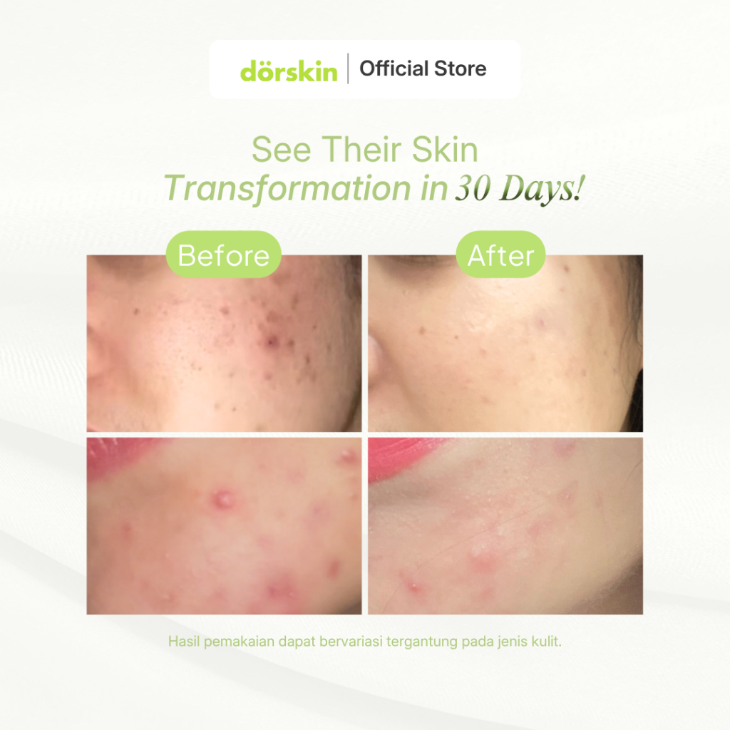Dorskin Kreasi Indonesia dörskin Matcha Glow Dream Mask