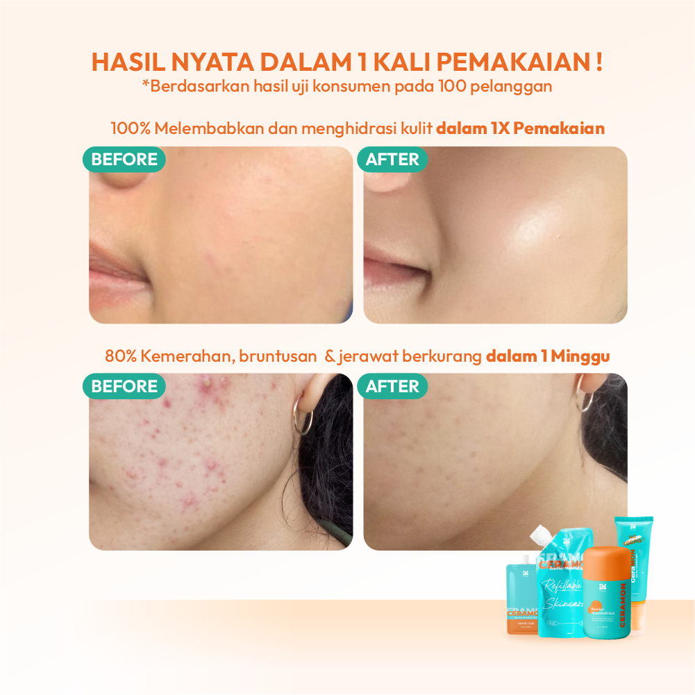 Pesona Dalam Negri Prettywell CeraMON Barrier Moistfull Gel