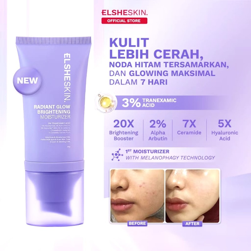 ELSHESKIN Radiant Glow Brightening Moisturizer 2