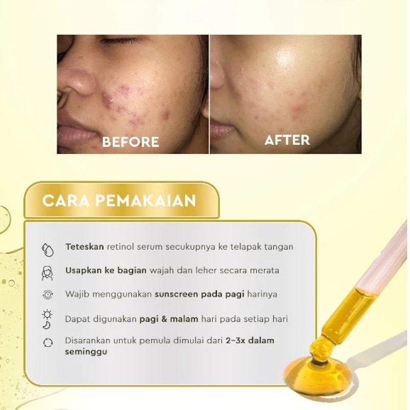 KYMM SKIN Gold Retinol Anti Aging Serum 5