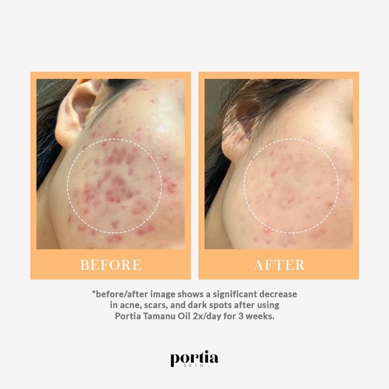 Laras Natura Portia Skin Tamanu Oil