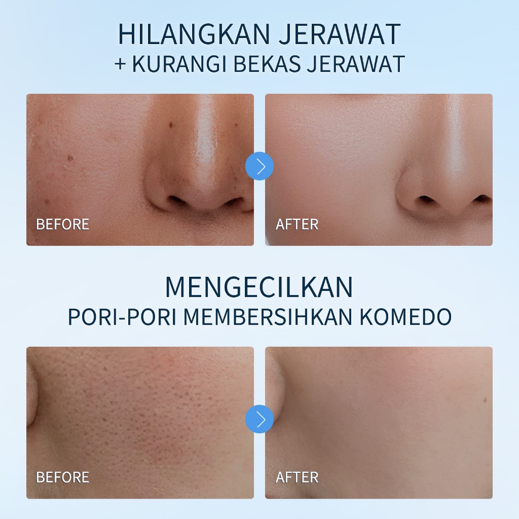 SpringOrigin SpringOrigin Lactobionic Acid Hydrating Cleansing Gel