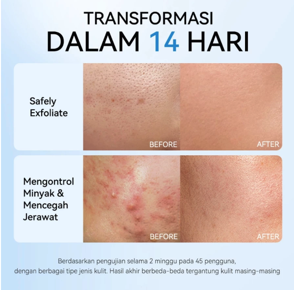 FCL Internasional Indonesia FOCALSKIN Oil Control Clear Pads 0,5% BHA