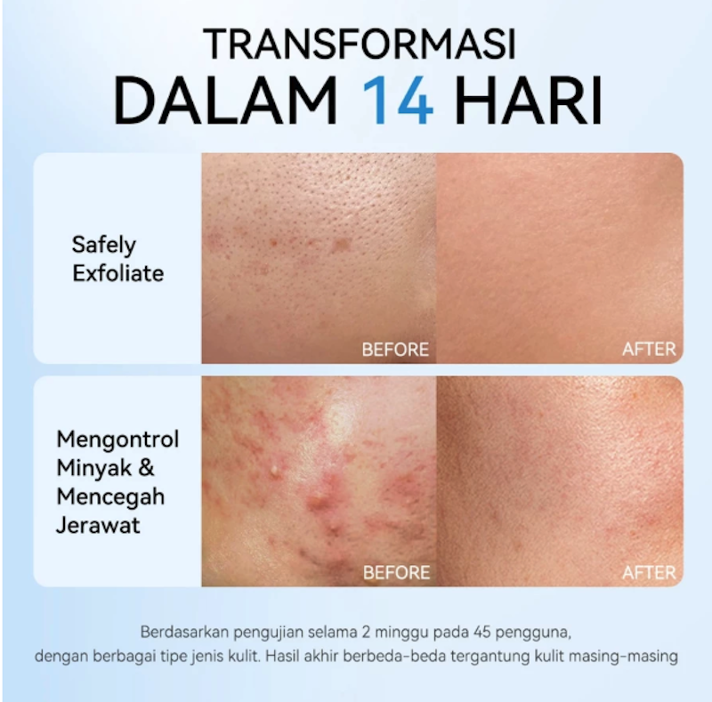 Oil Control Clear Pads 0,5% BHA 3