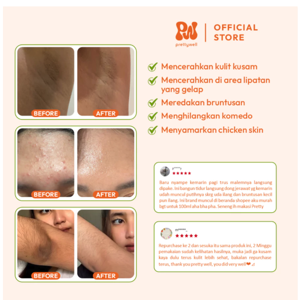 Pesona Dalam Negri Prettywell Feel Alive 2% PHA + BHA Gentle Exfoliating Toner New Year Edition