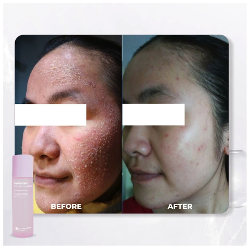 Airnderm Aesthetic Hydrating Primer Toner 5