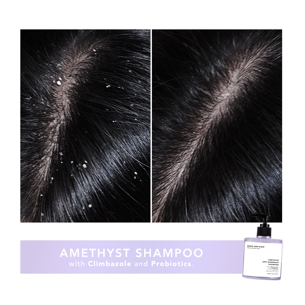 Grace and Glow Grace and Glow Amethyst Anti Dandruff Shampoo