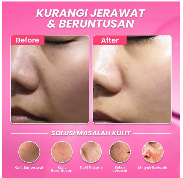 Eka Jaya Internasional Hanasui Anti Acne Serum