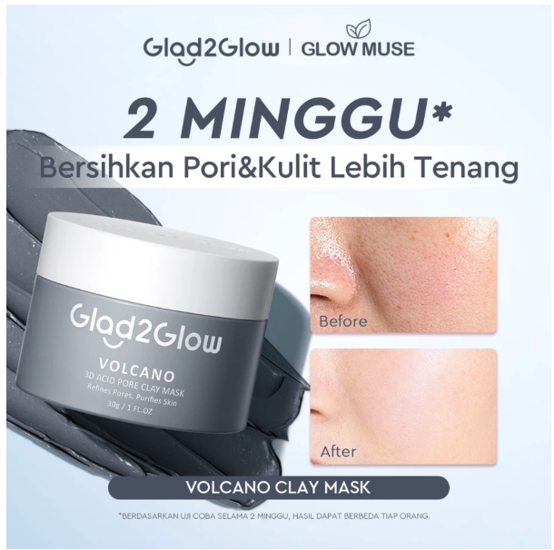  Glad2Glow Volcano 3D Acid Pore Clay Mask