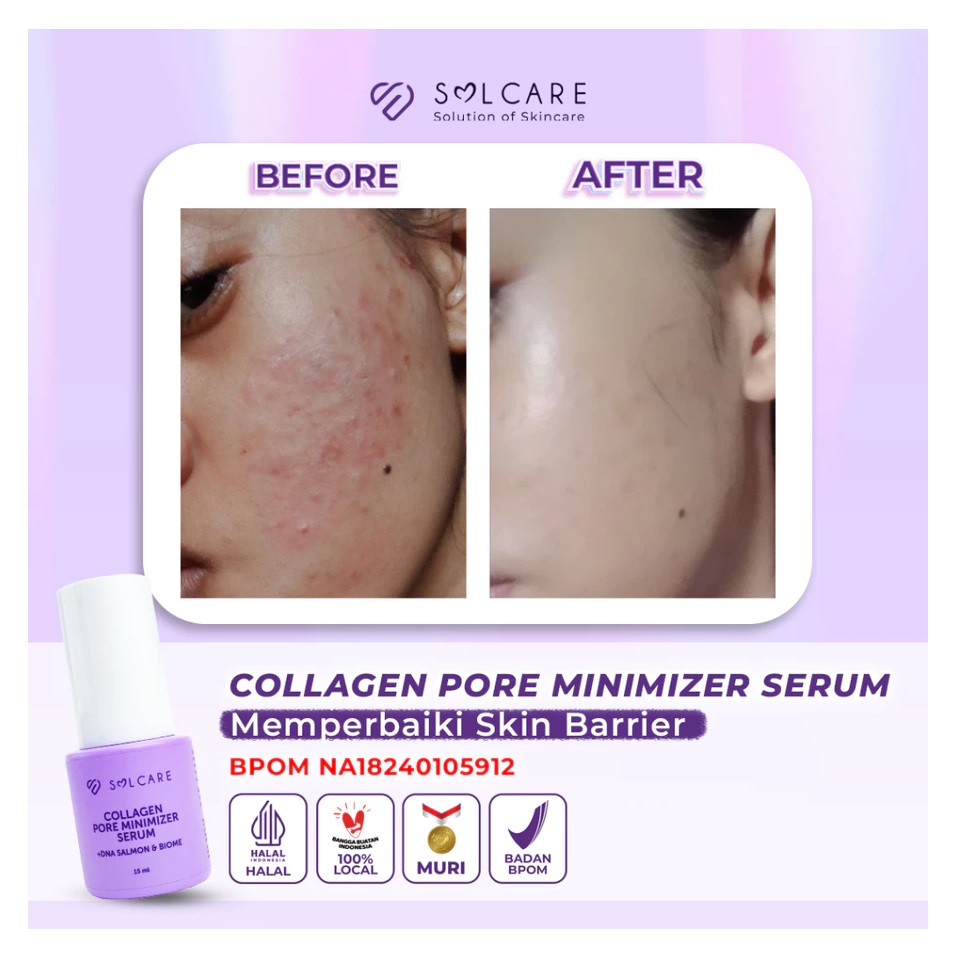 STC Sarana Estetika Solcare Collagen Pore Minimizer Serum