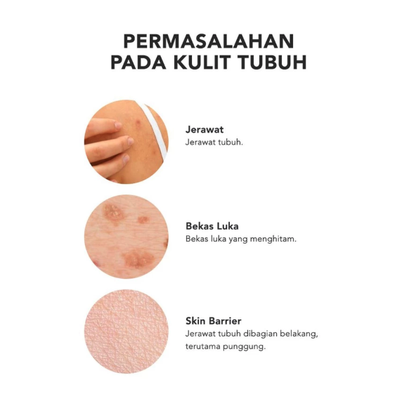 Shanghai Ayara Cosmetics Grace and Glow English Pear and Freesia Anti Acne & Scar Solution Body Serum