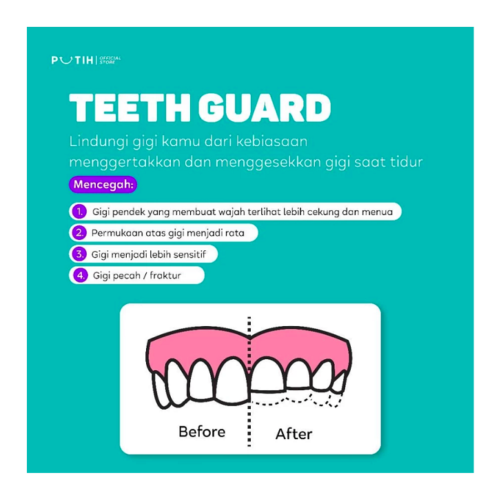 Putih by Dentist Putih Teeth Guard