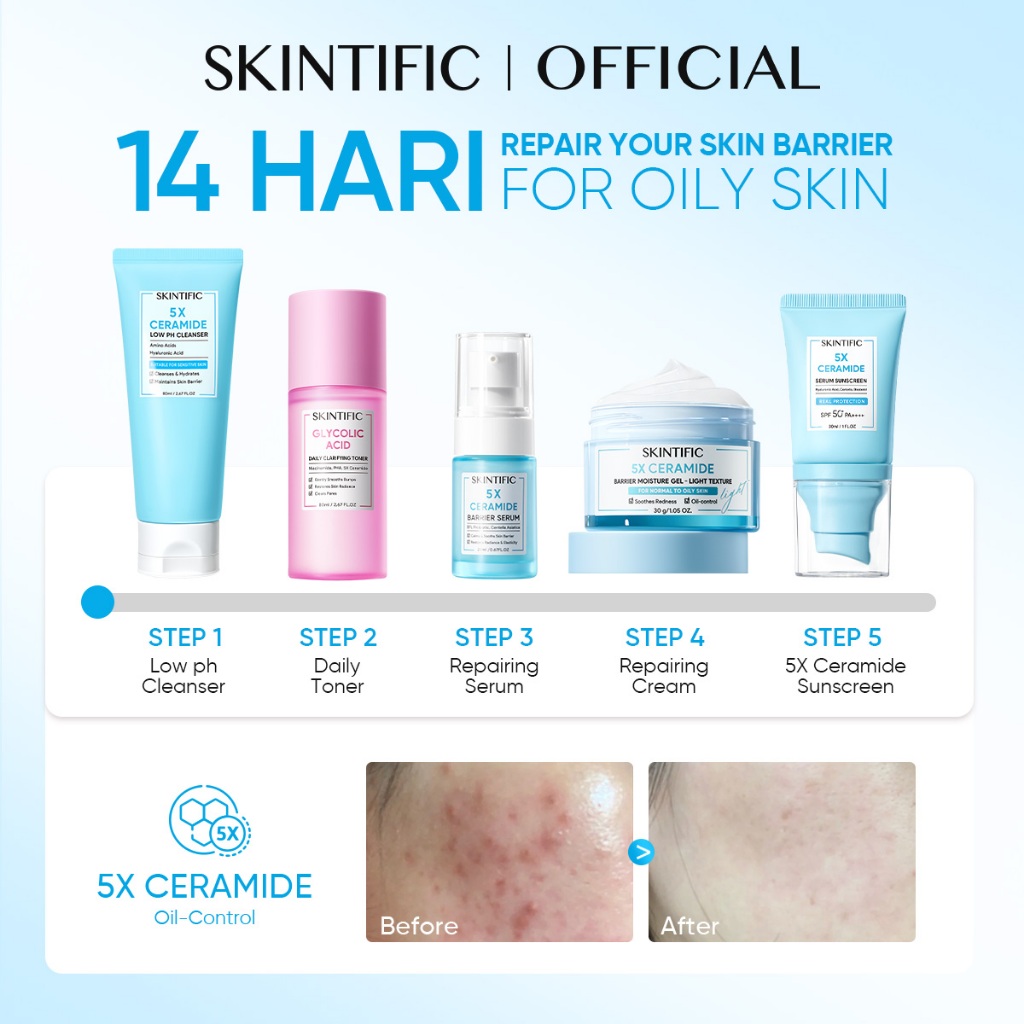 SKINTIFIC Cosmetics SKINTIFIC 5PCS Barrier Set for Oily Skin