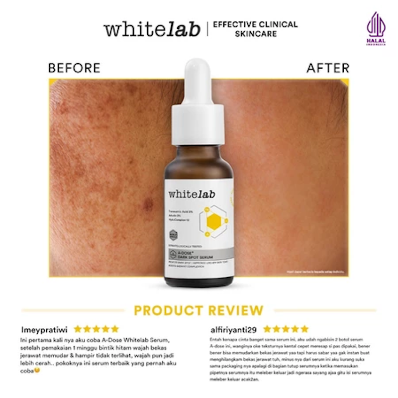 A-Dose+ Glowing Serum 4