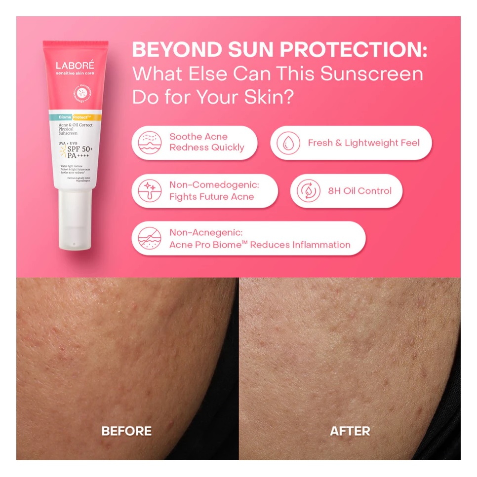 Paragon Technology and Innovation LABORÉ Sensitive Skin Care BiomeProtect™ Acne & Oil Correct Physical Sunscreen SPF50+ PA++++ 