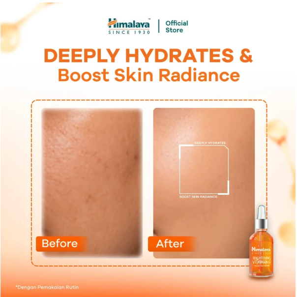 Himalaya Wellness Indonesia Himalaya Brightening Vitamin C Orange Face Serum