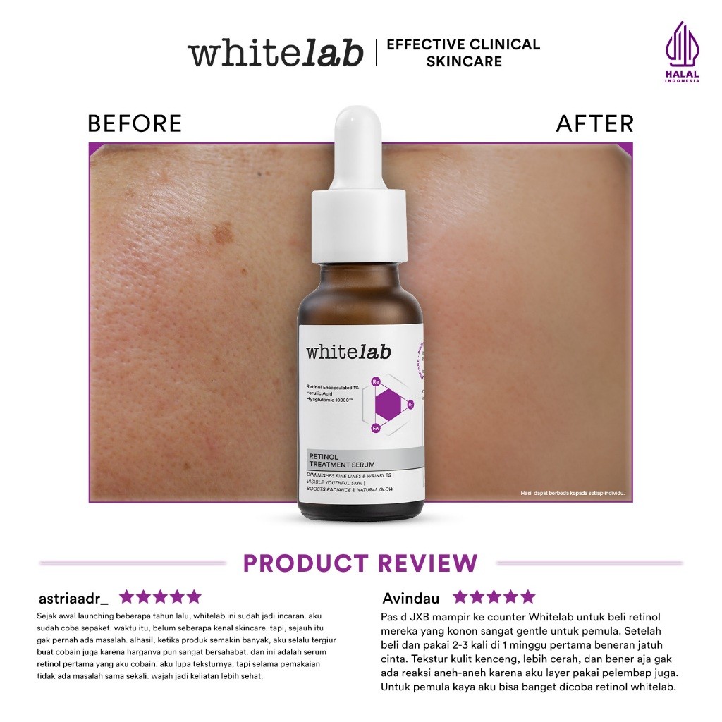Natura Deca Kosmetika Whitelab Retinol Treatment Serum
