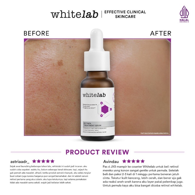 Retinol Treatment Serum 5