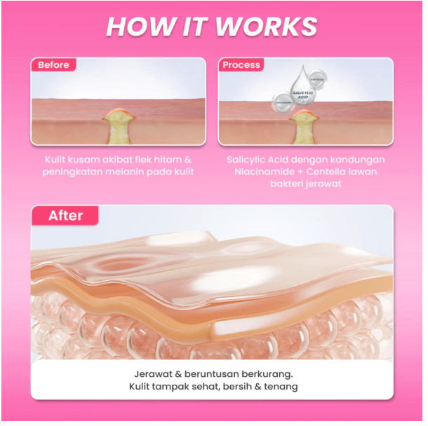 Eka Jaya Internasional Hanasui Anti Acne Serum