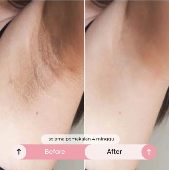  Haeuwon Shine Brightening Underarm Cream