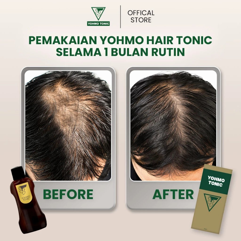 Yohmo Hair Tonic Classic 4