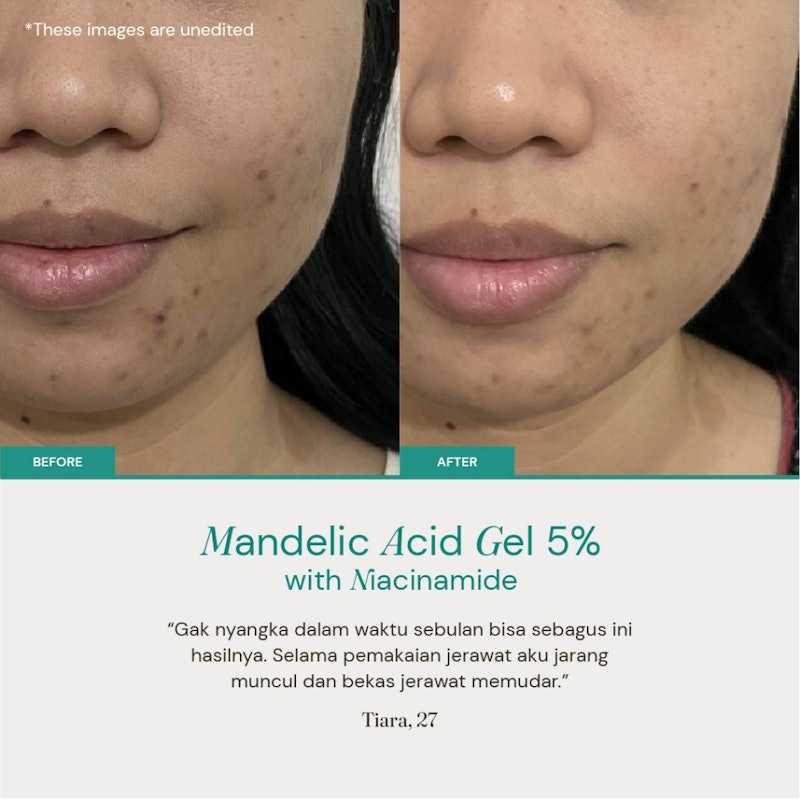 For Skin's Sake Mandelic Acid Gel 5% with Niacinamide 2