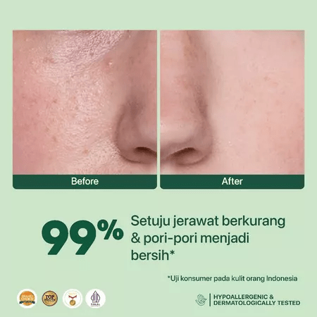 Penta Natural Kosmetindo N'PURE Acne Clear Hydrating & Calming Toner