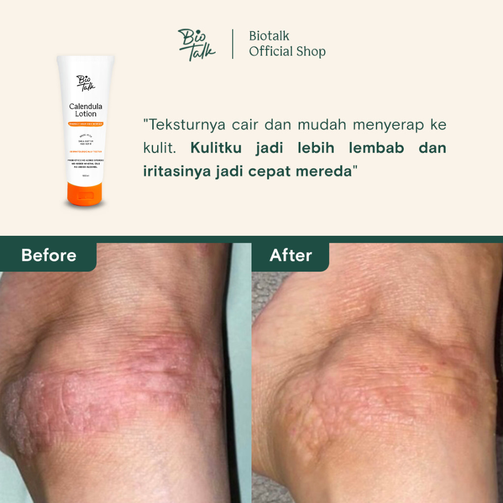Bionatura Berkat Abadi BioTalk Calendula Lotion For Eczema and Dry Skin
