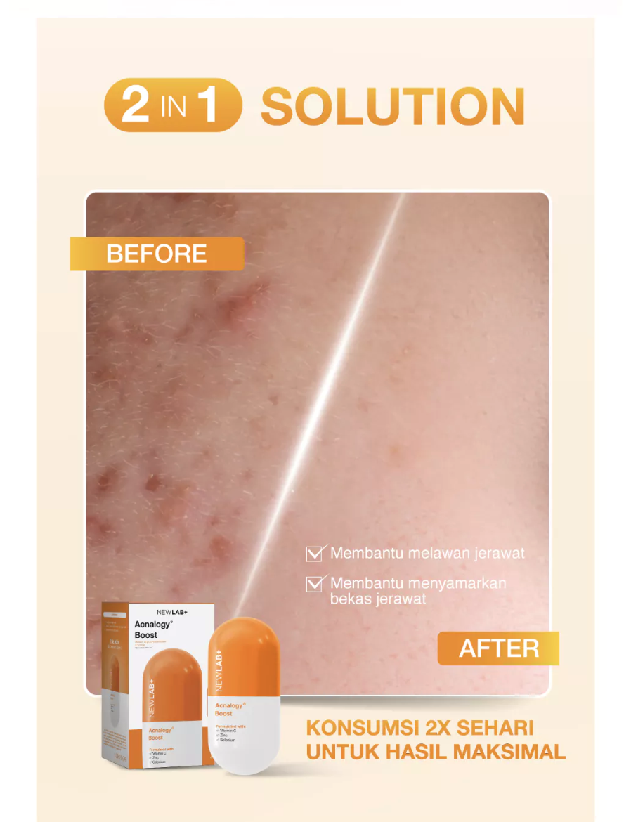  NEWLAB Acnalogy Boost