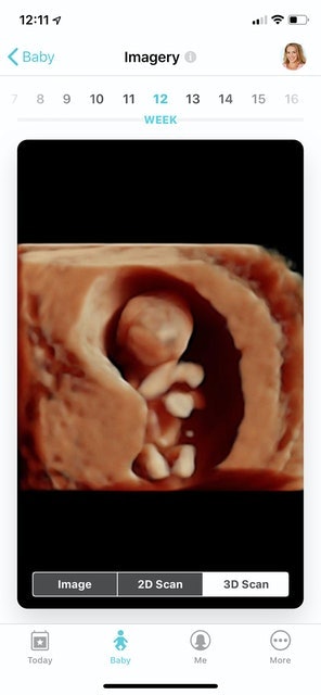 Pregnancy+ 3