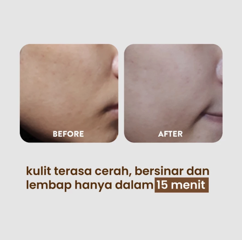 Licorice Ultra Light Complete Face Essence Sheet Mask 4