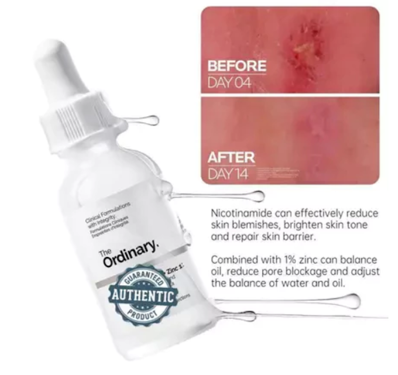 Niacinamide 10% + Zinc 1% 4