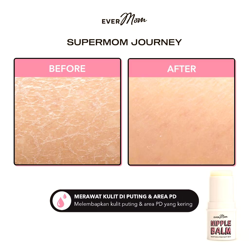 Mitra Putri Abadi Evermom Nipple Balm