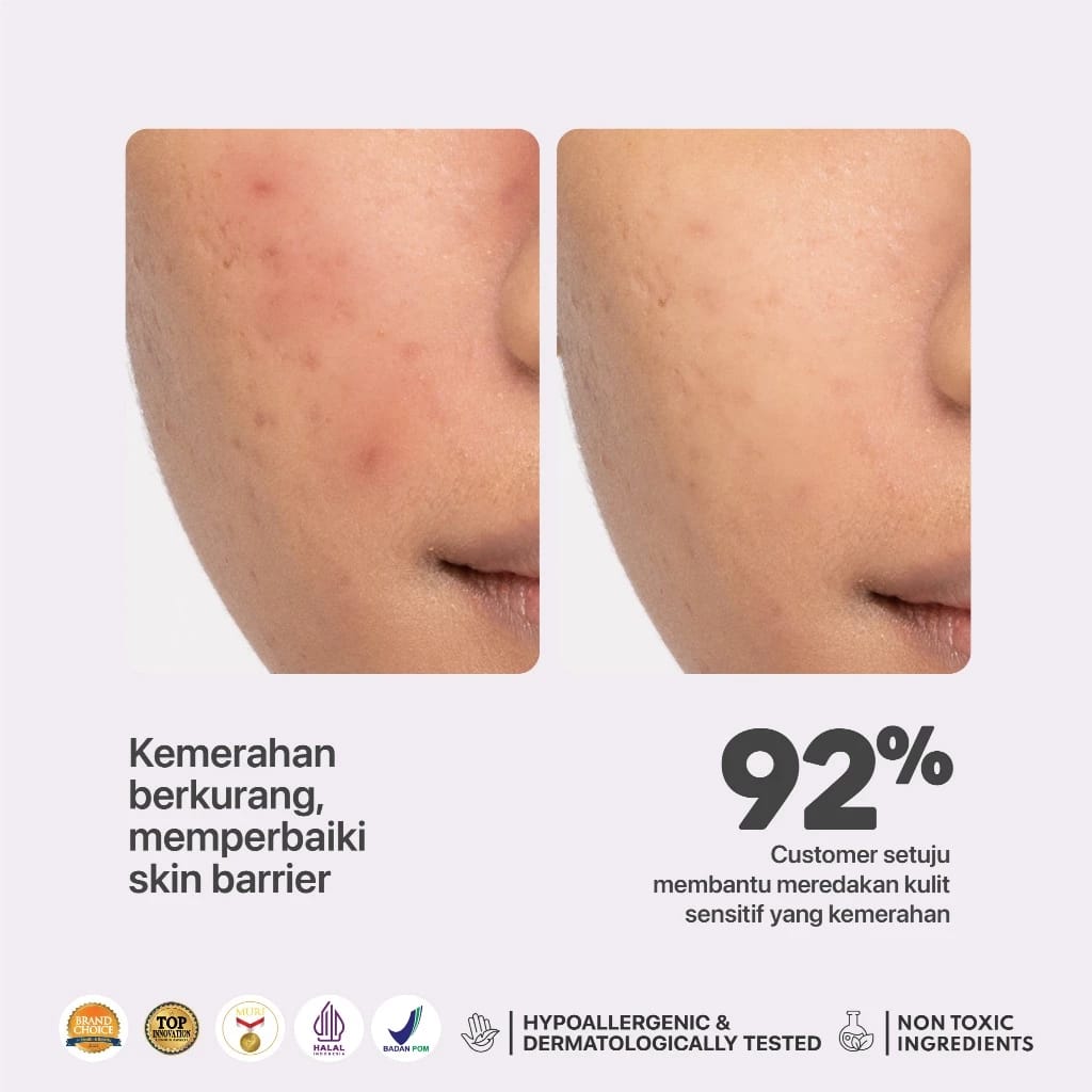 Penta Natural Kosmetindo N'PURE Noni Probiotics Hypoallergenic Calm Me Down Sensitive Face Serum