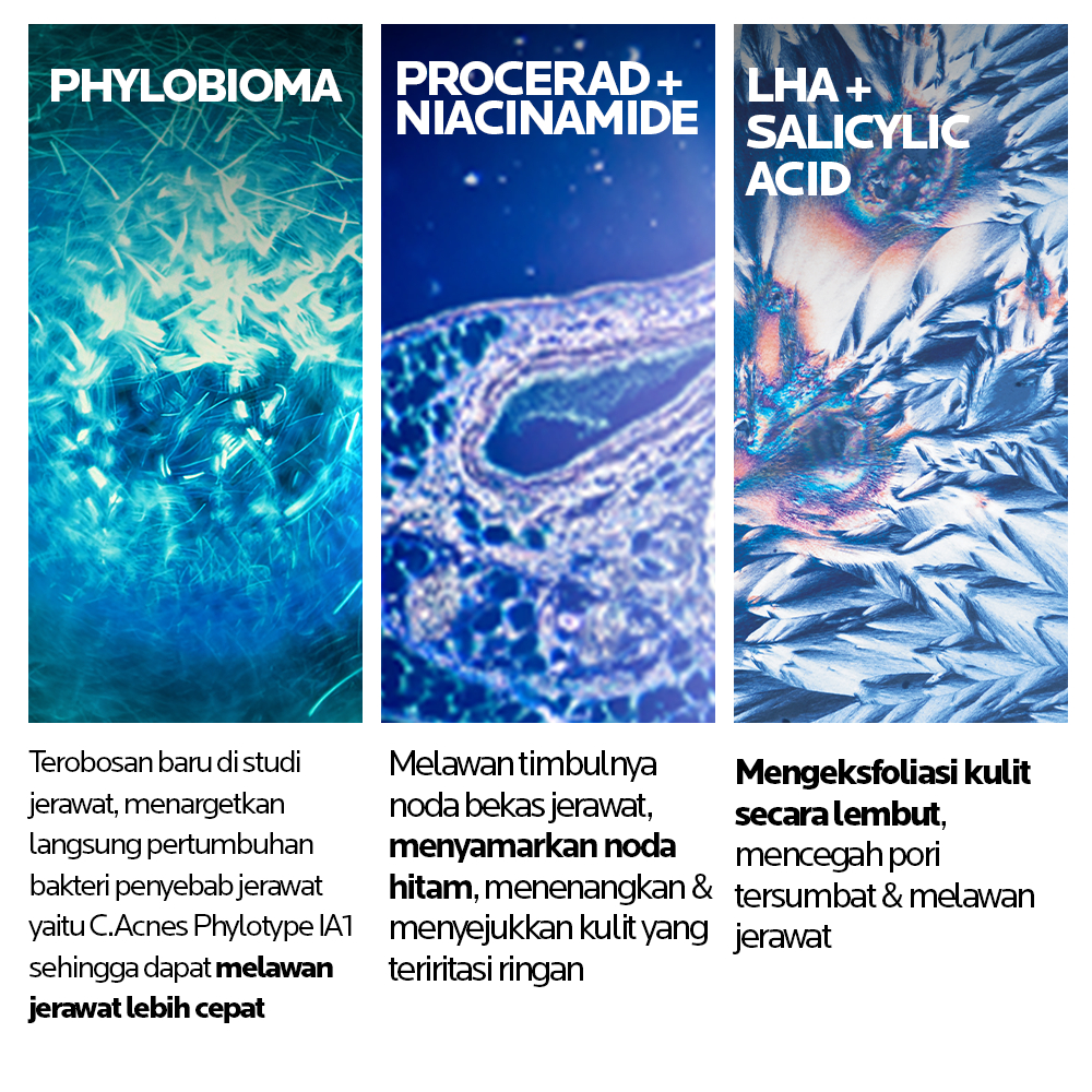 L'Oréal Indonesia La Roche-Posay Effaclar Duo+M Moisturizer / Acne Spot Treatment