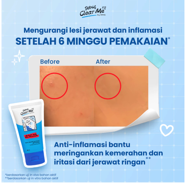ERHA Clinic Indonesia Dermies Clear Me Acne Smooth Sunscreen SPF 30 PA++