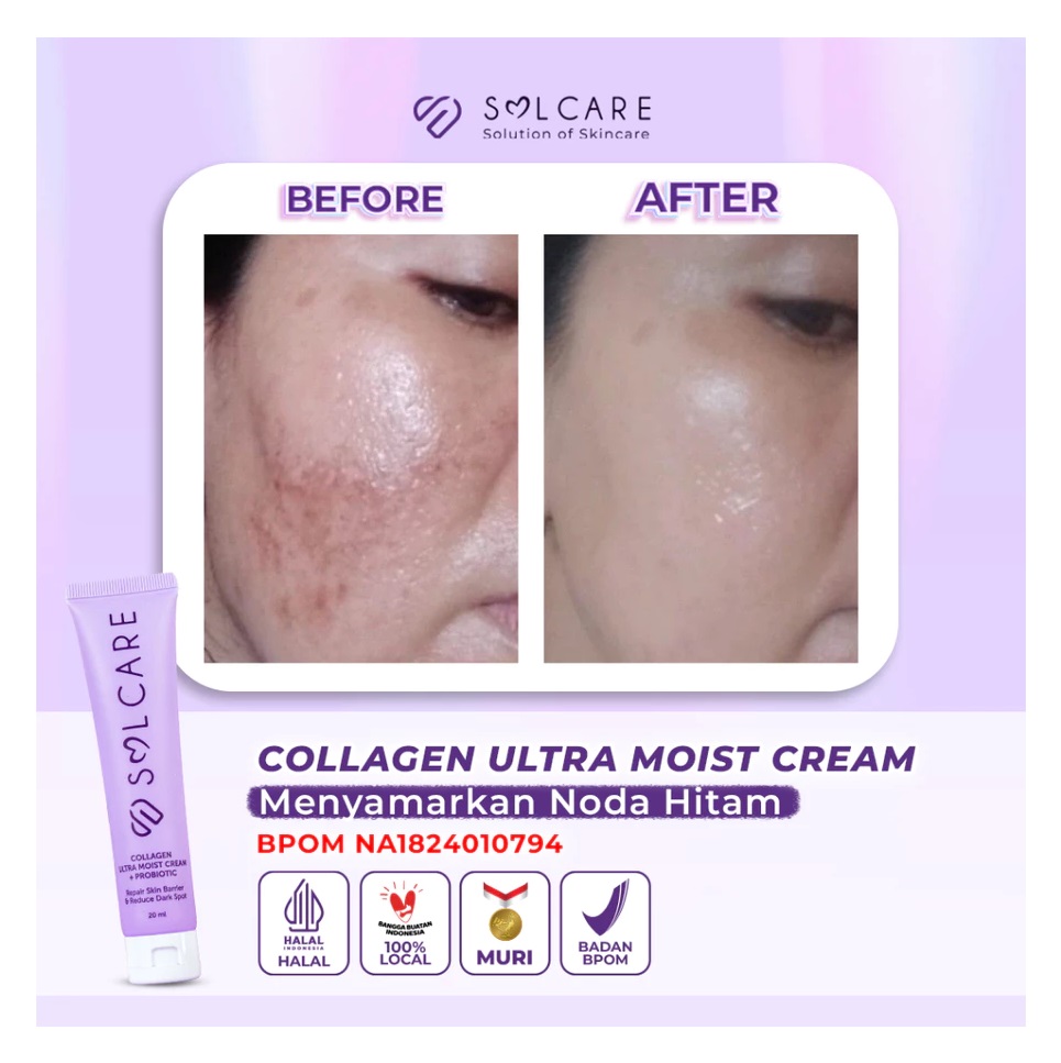 STC Sarana Estetika Solcare Collagen Ultra Moist Cream + Probiotic