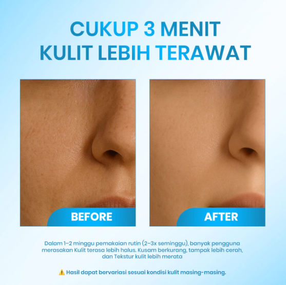  Aura Harmoni Estetika Cleora Beauty 3 Minutes Exfoliating Gel