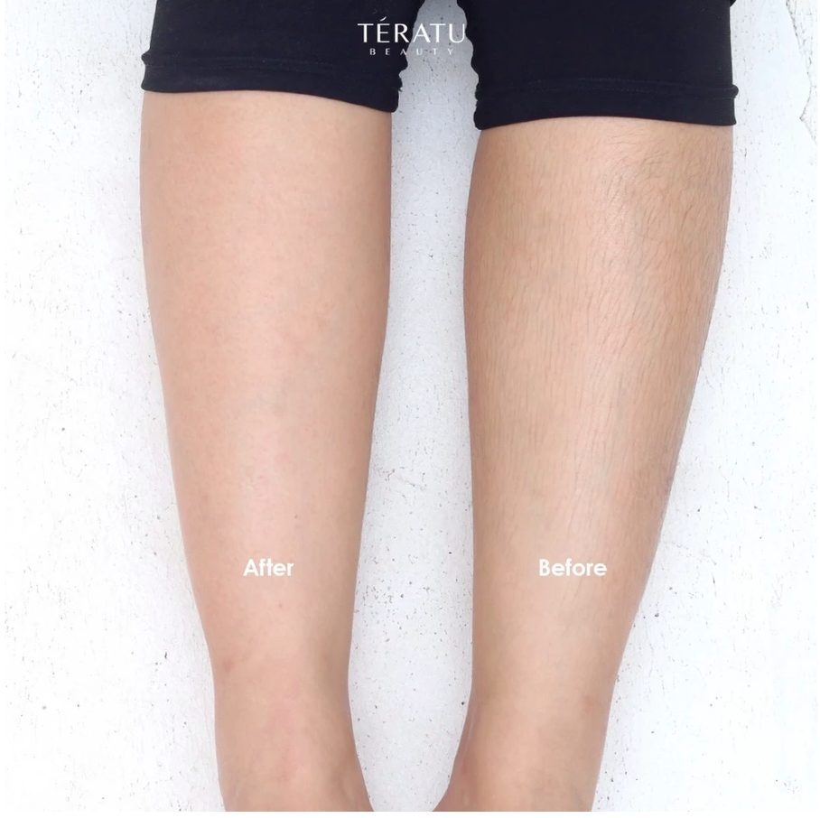 Fandi Universal Kosmekreasi Tératu Beauty Hair Free Sugar Wax