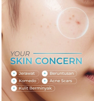 Paragon Technology and Innovation Wardah Acnederm Salicylic Acid Zinc Acne Clearing Low pH Foaming Cleanser